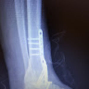 Meet your Posher, Toni